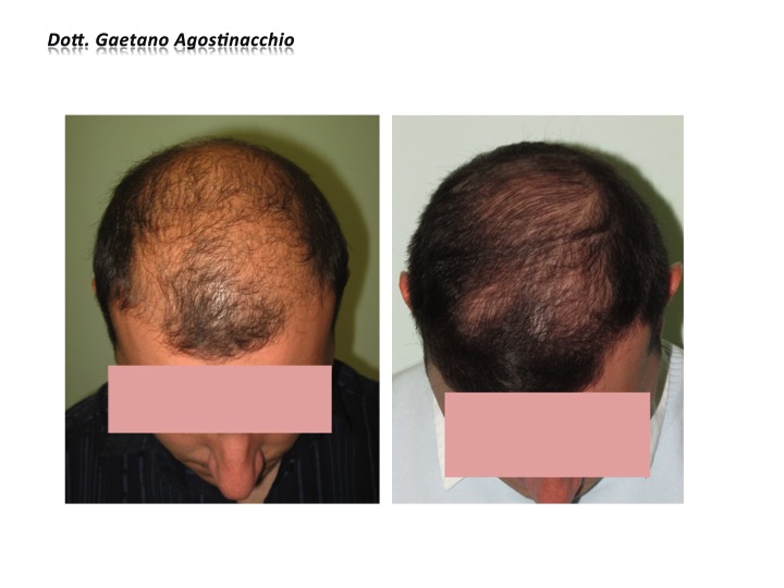 Diapositiva12 Diapositiva12