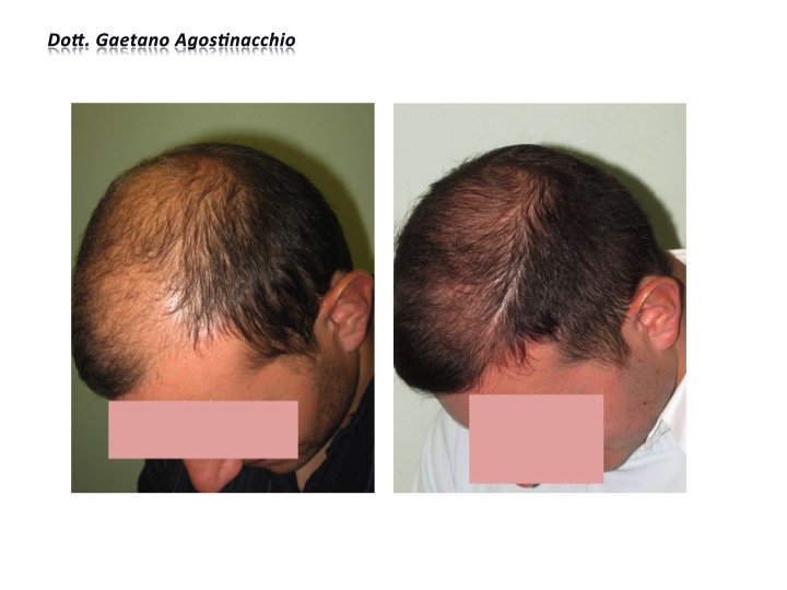 Diapositiva13 Diapositiva13