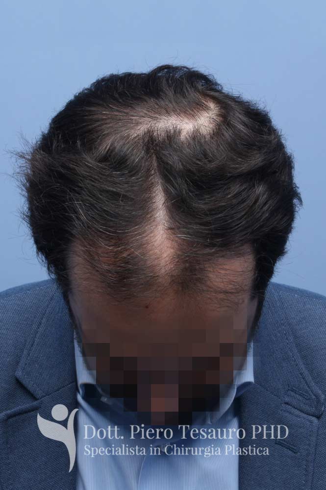 terapia tricologica3