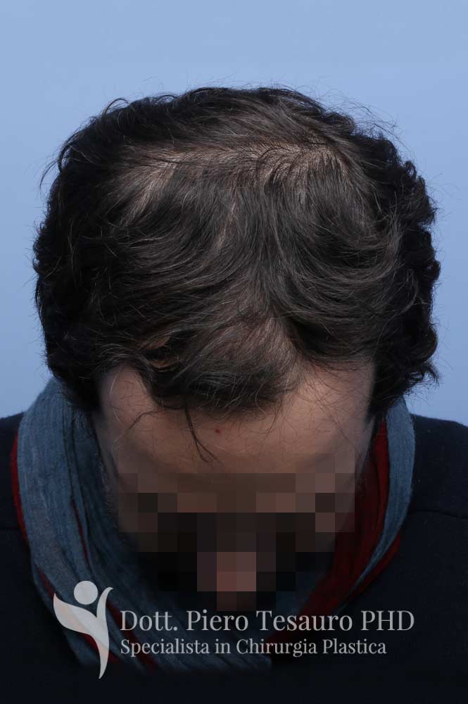 terapia tricologica4