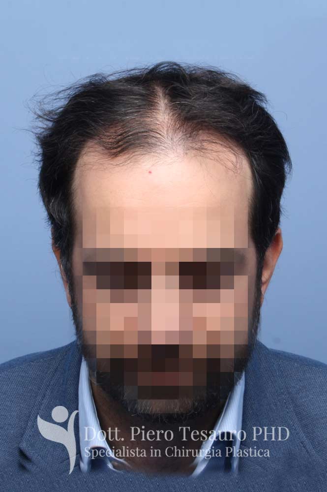 terapia tricologica5