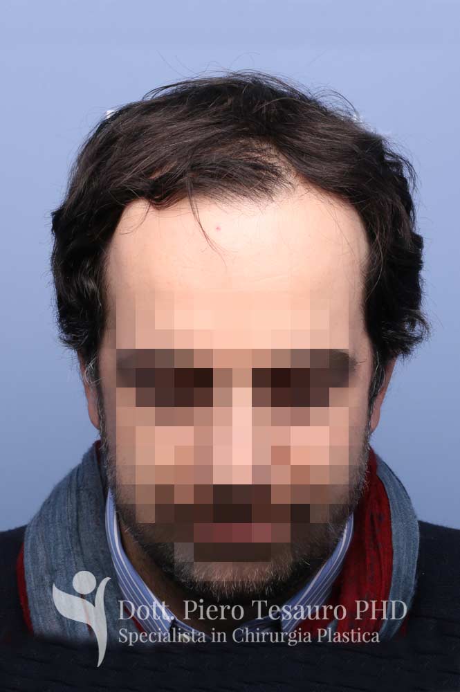 terapia tricologica6